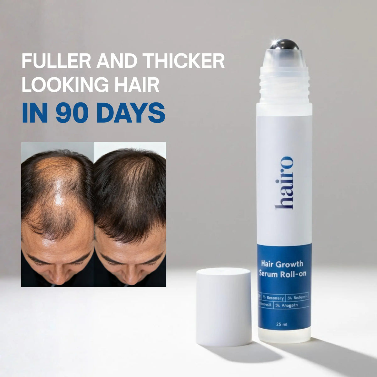 Advanced Hair Growth Roll-On Serum