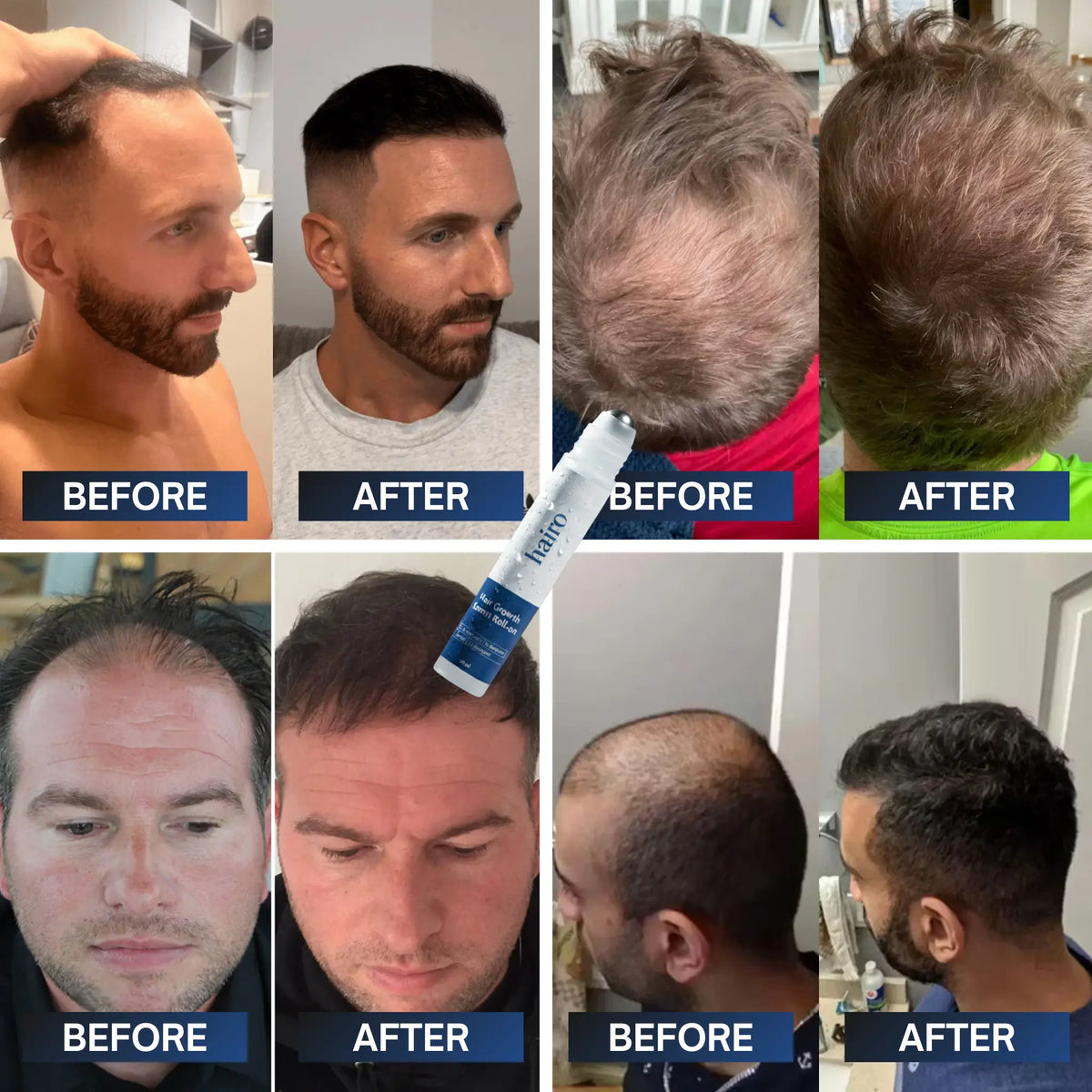 Advanced Hair Growth Roll-On Serum