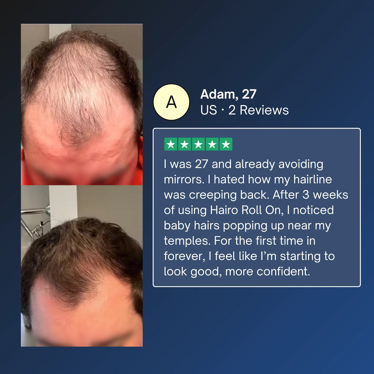 Advanced Hair Growth Roll-On Serum